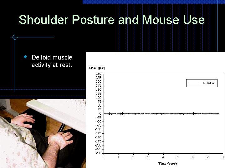 Shoulder Posture and Mouse Use